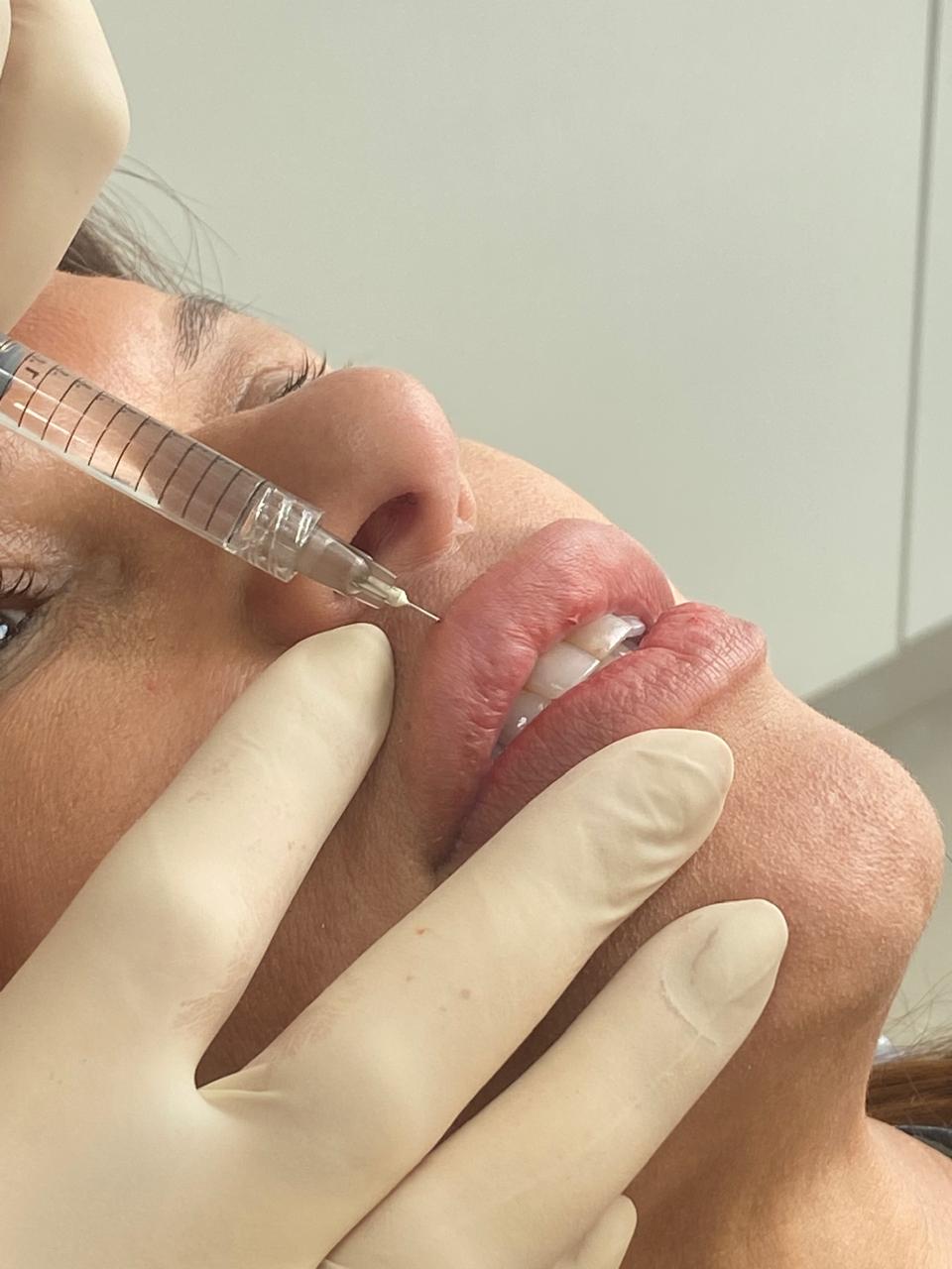 Harmonização Orofacial