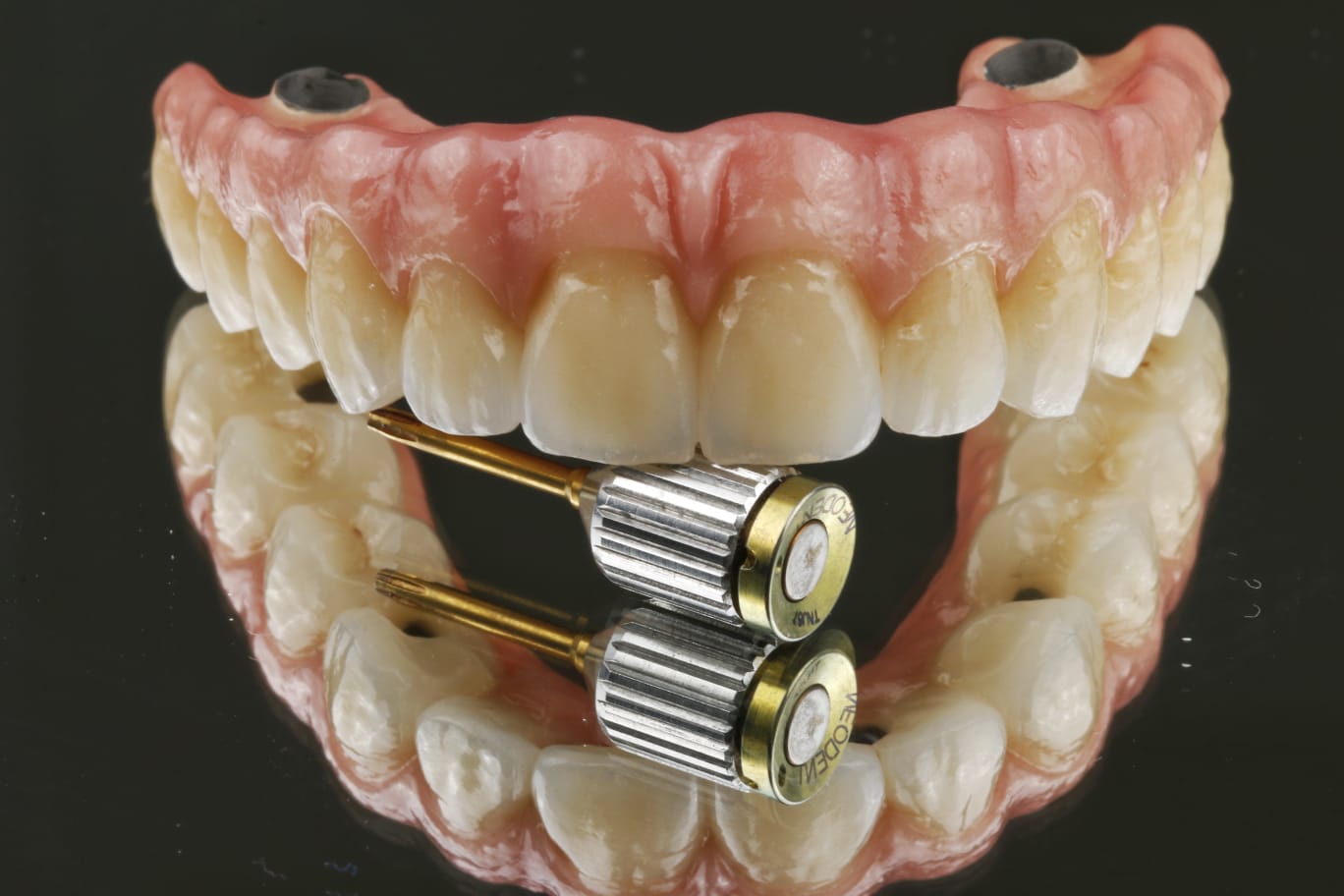 Implantes Dentários